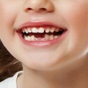 También a Jesús se le cayeron los dientes