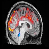 El cerebro y el líquido que lo limpia