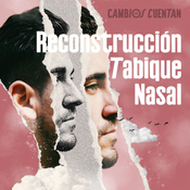 Episodio 3: Reconstrucción del tabique nasal