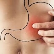 Onda Salud - Sanciones al volante - Parálisis Cerebrra- Gastroenteritis