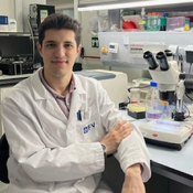 Gliomas: Entre células, ciencia y esperanza