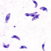T1X00 (piloto) Toxoplasma